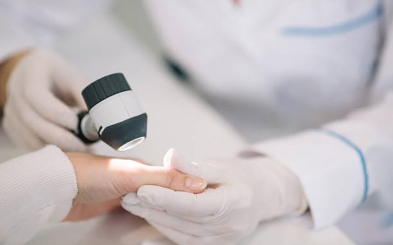 Dermatologist to Treat Acne