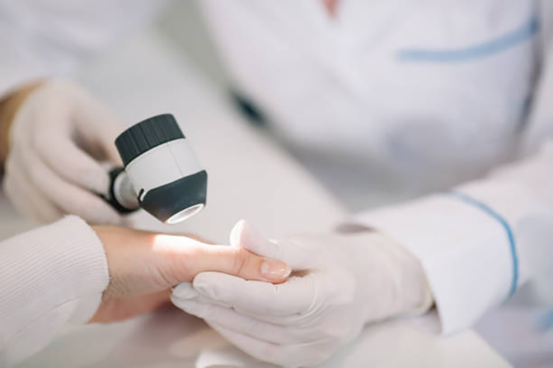 Dermatologist to Treat Acne